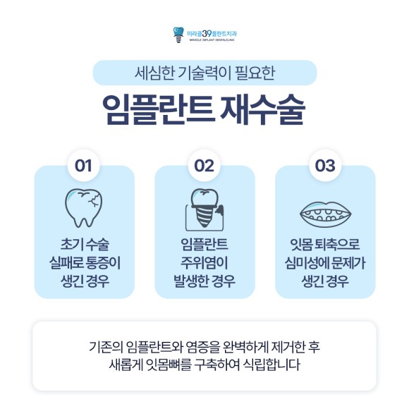 임플란트 재수술