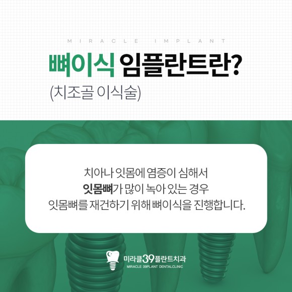 뼈이식 임플란트